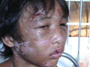 be_tho_bi_chu_hanh_ha