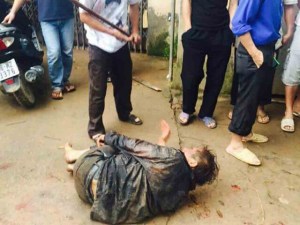 trom_cho_bi_danh_chet